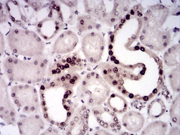 LRP1 Antibody