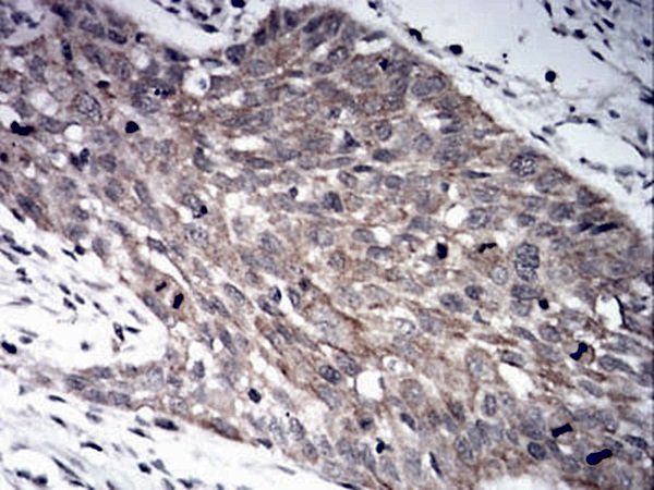 LRP1 Antibody