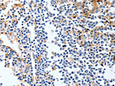 LRP1 Antibody
