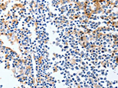 LRP1 antibody