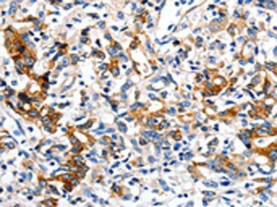 LRP1 Antibody