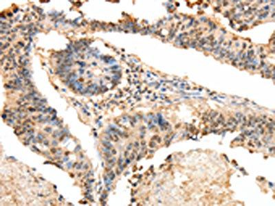 LRP12 Antibody