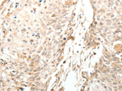 LRP12 Antibody