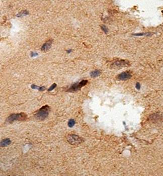 LRP12 Rabbit Polyclonal Antibody