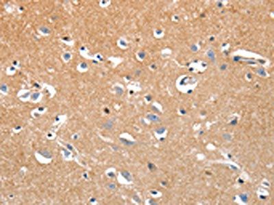 LRP3 Antibody