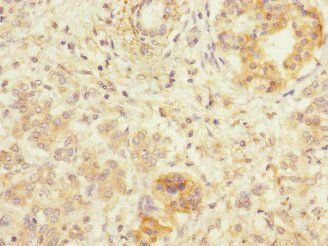 LRP4 Antibody