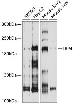 LRP4 antibody
