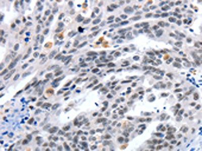 LRP5 antibody