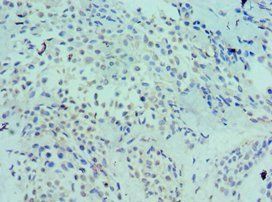 LRP6 antibody