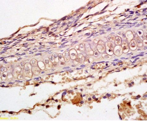LRP6 Rabbit Polyclonal Antibody