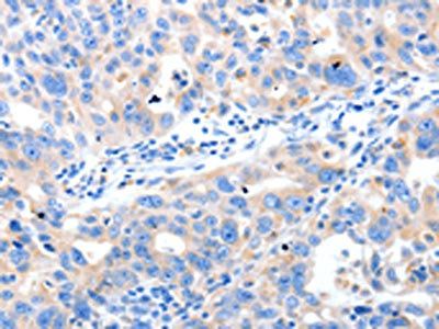 LRPAP1 antibody