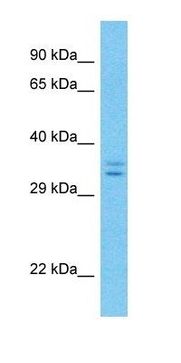 LRRC10B antibody