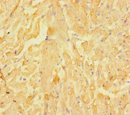 LRRC15 Antibody