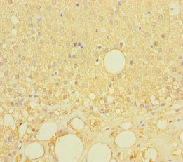 LRRC19 Antibody