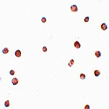LRRC19 Antibody