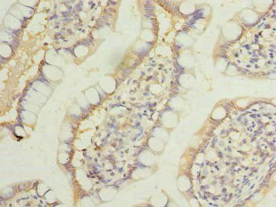 LRRC39 Antibody