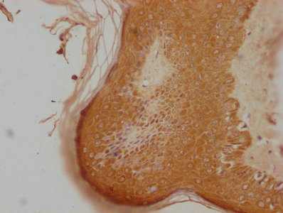LRRC3C Antibody