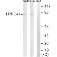 LRRC41 antibody