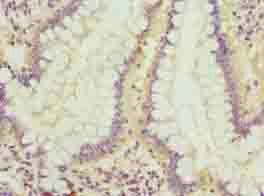 LRRC42 Antibody
