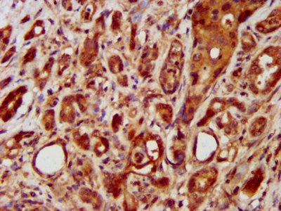 LRRC45 Antibody