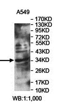 LRRC46 Rabbit Polyclonal Antibody