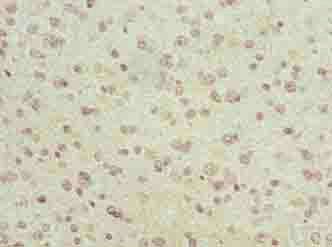 LRRC4C Antibody