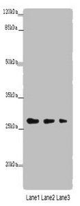 LRRC57 antibody