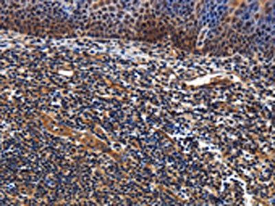 LRRC57 Antibody