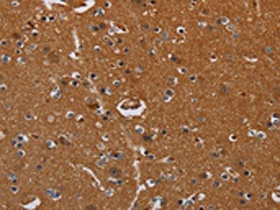 LRRC57 Antibody