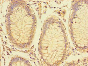 LRRC61 Antibody