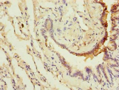 LRRC8E Antibody