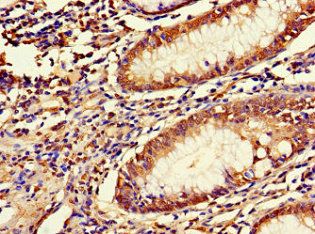 LRRIQ3 Antibody
