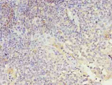 LRRN1 antibody