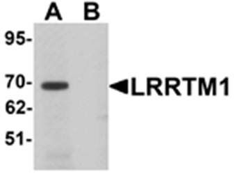 LRRTM1 Antibody