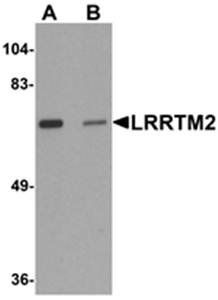 LRRTM2 Antibody