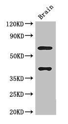 LRRTM4 antibody