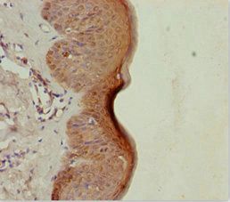 LRSAM1 Antibody