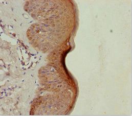 LRSAM1 antibody