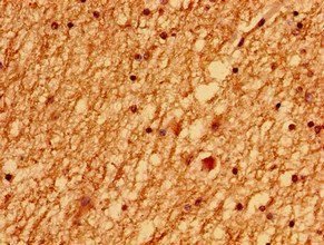 LSM1 Antibody