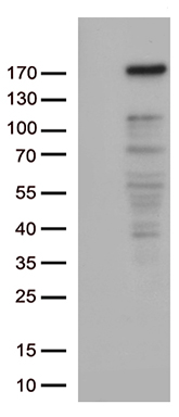 LSM11 antibody