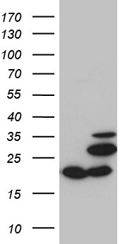 LSM11 Antibody