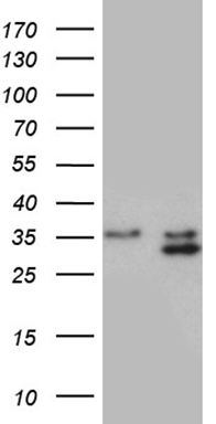 LSM11 Antibody