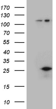 LSM11 Antibody