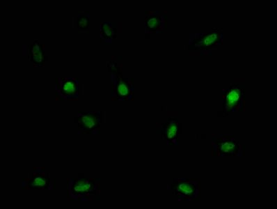 LSM11 antibody