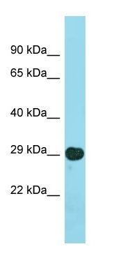 LSM14B antibody