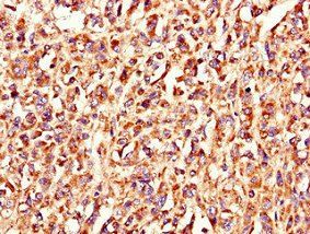LSMEM1 Antibody