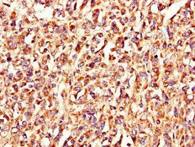 LSMEM1 antibody