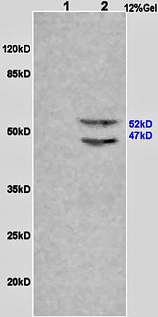 LSP1 (phospho-Ser204) antibody