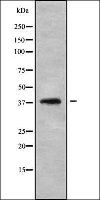 LT4R1 antibody