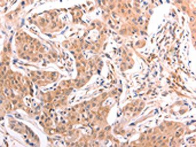LTA Antibody